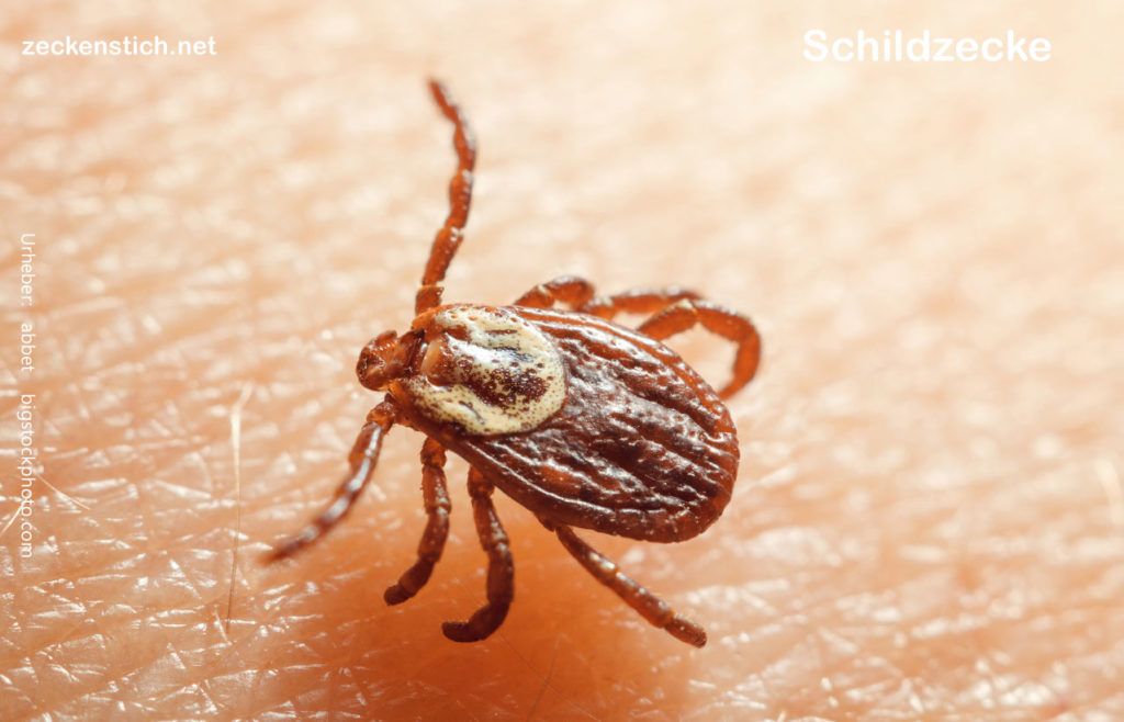 Schildzecke